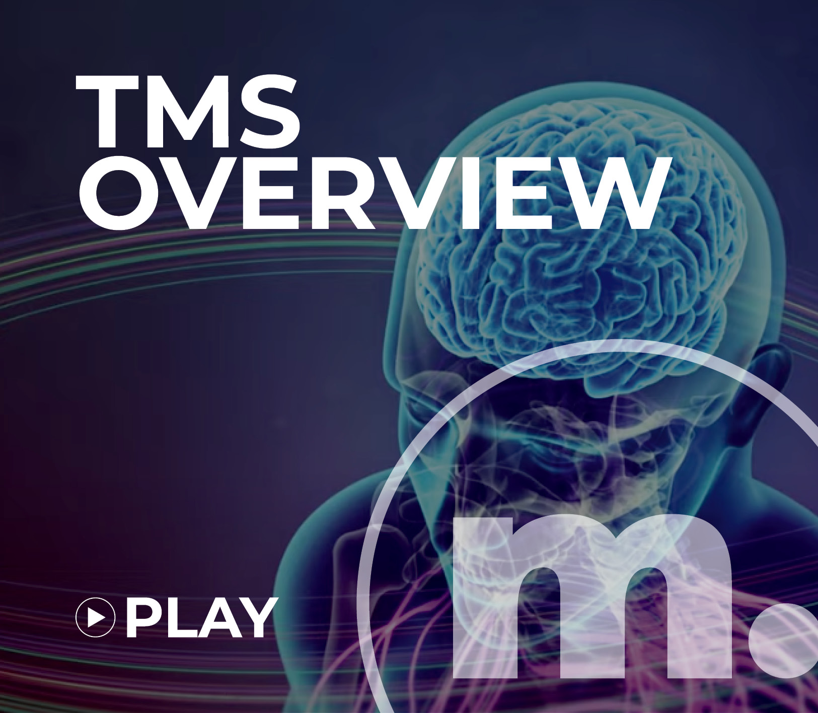 Magstim TMS Overview