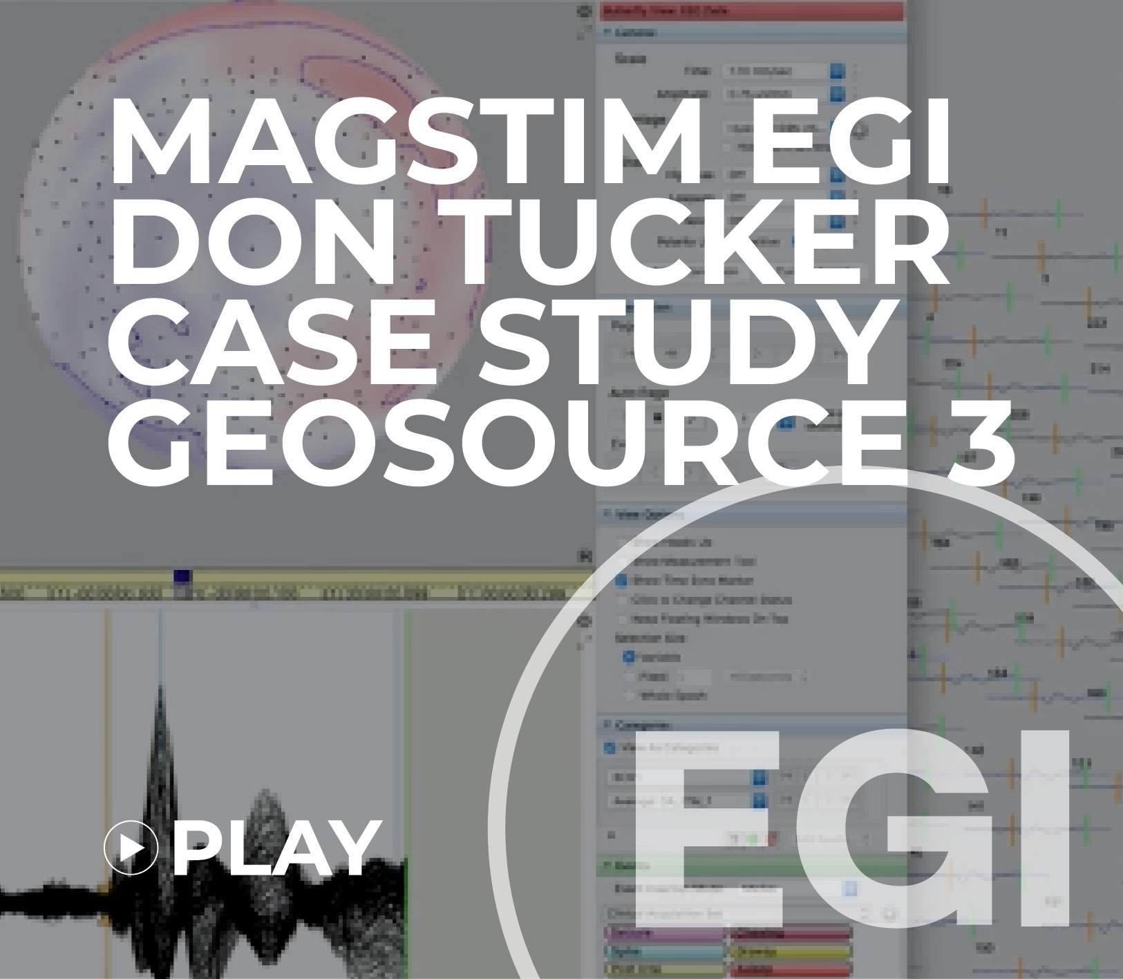 Magstim EGI CEO Don Tucker discusses a case study using GeoSource 3 Research