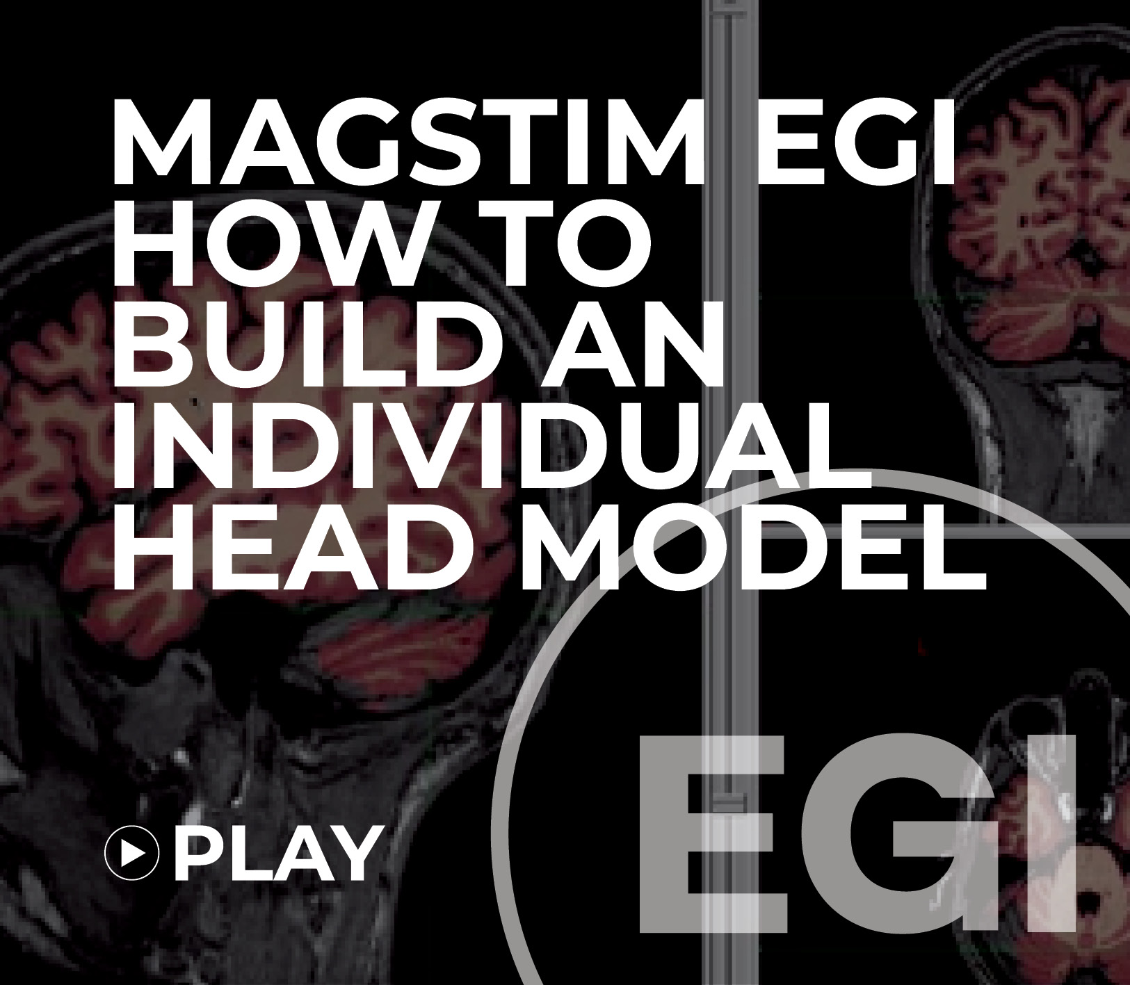 Magstim EGI How to build an Individual Head Model