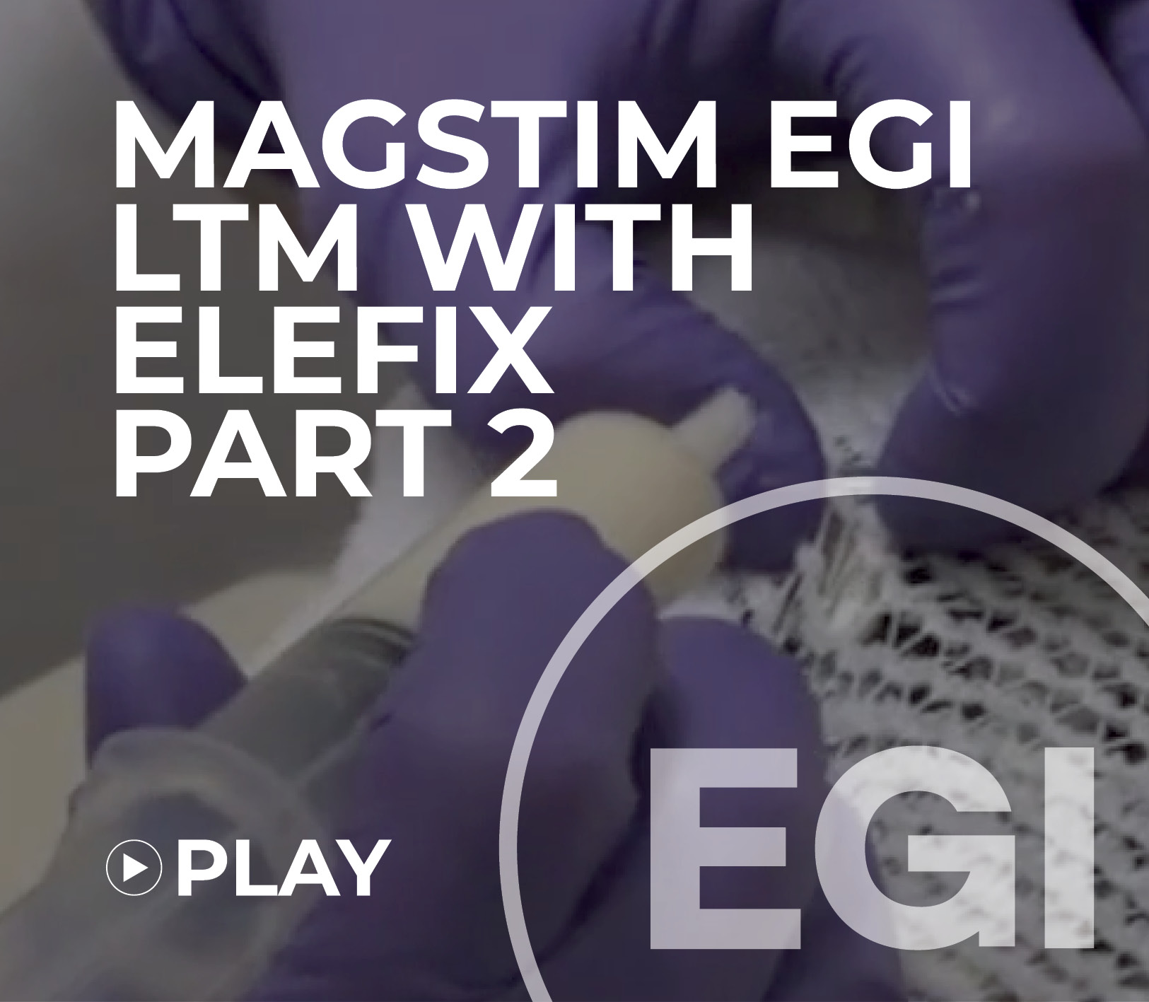 Magstim EGI LTM with Elefix part 2
