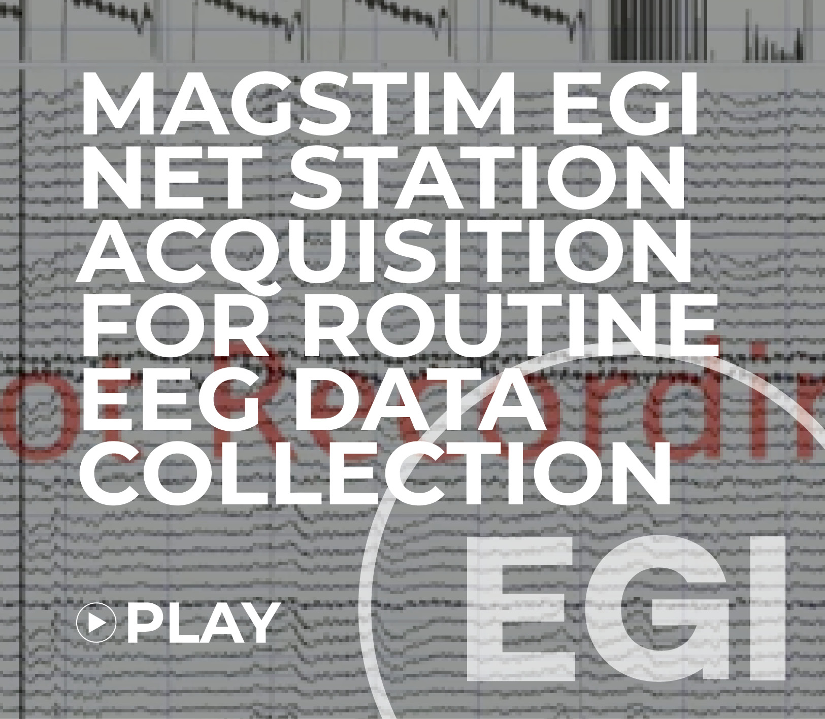 Magstim EGI Net Station Acquisition for Routine EEG data collection