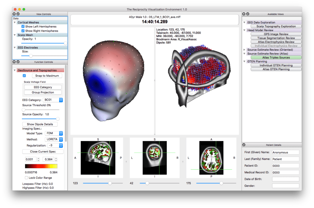 EGI Screen_Shot_2017-05-25_at_10.54.04_AM
