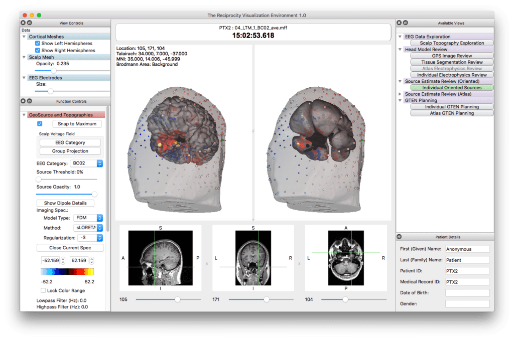 EGI Screen_Shot_2017-05-25_at_11.01.11_AM